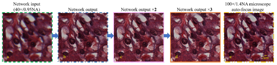 Deep learning microscopy